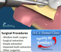 Slider image (3) Dental Clinic OCI Tamarindo